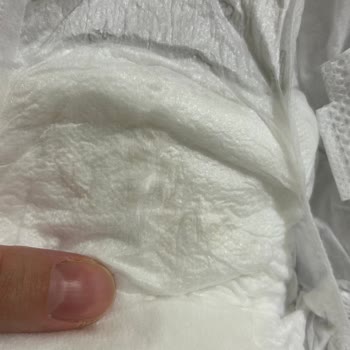 Bebek Bezi Kalitesizliği Ve Cilt Sorunları