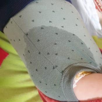 Sleepy Bebek Bezi Sızıntı Sorunu Ve Destek Eksikliği