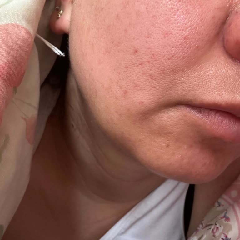 Yanlış Yönlendirme Ve Kalıcı Hasar