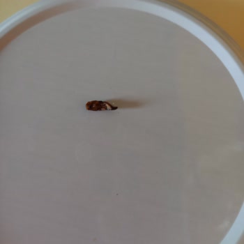 Cips Paketinden Çıkan Parazit Şoku