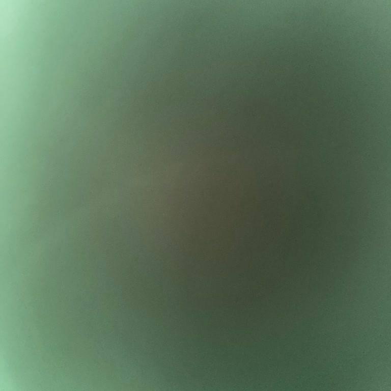 Doktorun Sivilce İlacı Ve Ekstra Ücret Politikası