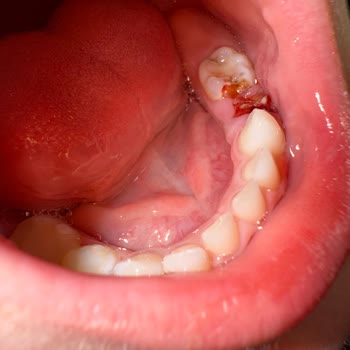 Doktor Hatası: Oğlumun Diş Sağlığı Tehlikede