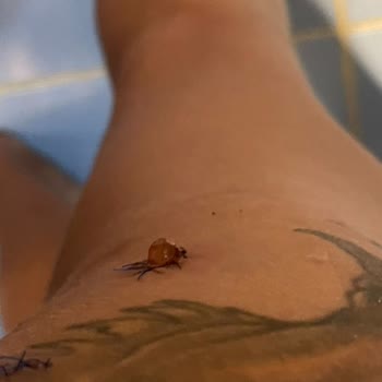 Estetik Operasyon Sonrası Hayal Kırıklığı Ve Sağlık Sorunları