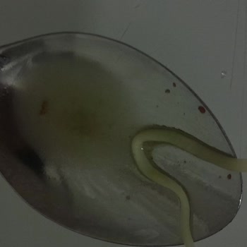 Noodle Ürünü İçinde Böcek Parçaları