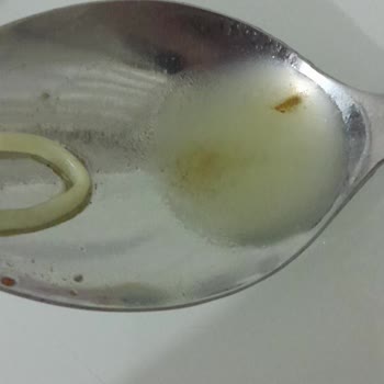 Noodle Ürünü İçinde Böcek Parçaları