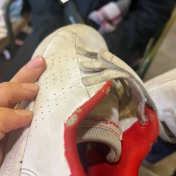 Adidas Ayakkabının Hızla Yıpranması ve İade Sorunu