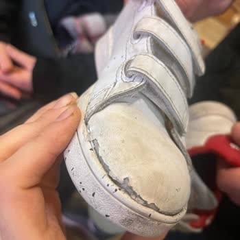 Adidas Ayakkabının Hızla Yıpranması ve İade Sorunu