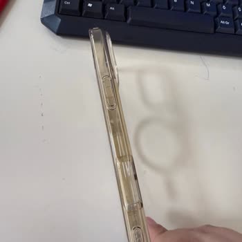 Spigen Kılıfın Hızla Sararması Ve Memnuniyetsizlik