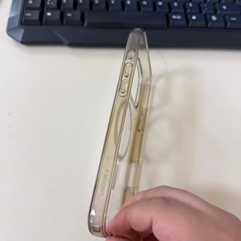 Spigen Kılıfın Hızla Sararması Ve Memnuniyetsizlik