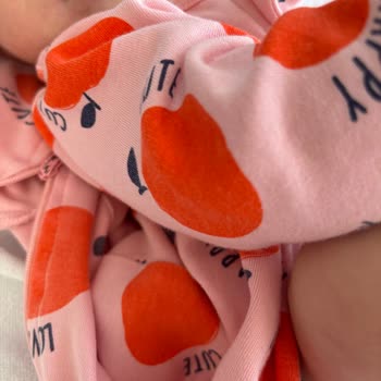 Bebek Tulumunun Renk Solması Sorunu