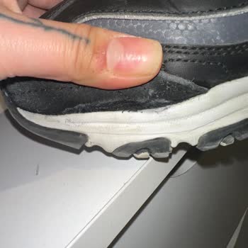 Ayakkabıda Boya Akması Ve Kalitesizlik Sorunu