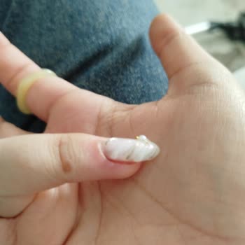 Manikür Sırasında İlgisizlik Ve Hijyen Sorunları Yaşadım