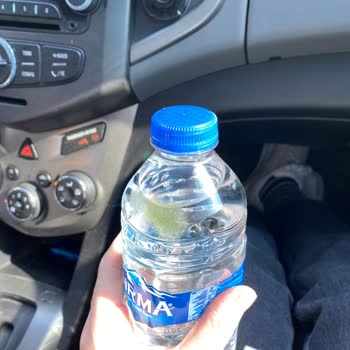 Sırma Su İçinde Sarımsı Jölemsi Madde Şoku