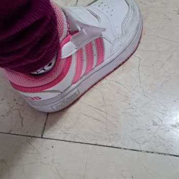 Adidas Ayakkabının Sürekli Açılan Cırt Sorunu