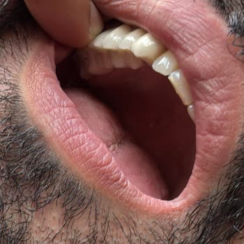 Diş Tedavisinde Mağduriyet Ve Çözüm Arayışı