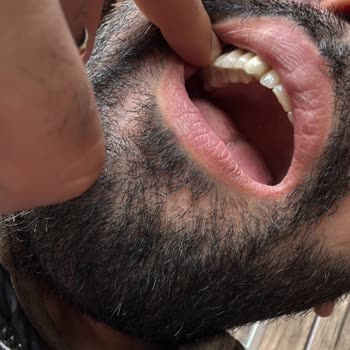 Diş Tedavisinde Mağduriyet Ve Çözüm Arayışı