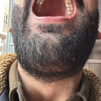 Diş Tedavisinde Mağduriyet Ve Çözüm Arayışı