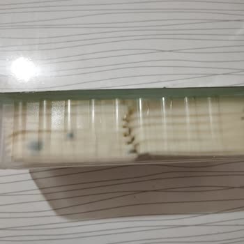 Şok Marketler Küflü Peynir Ve Bitmeyen İade Süreci