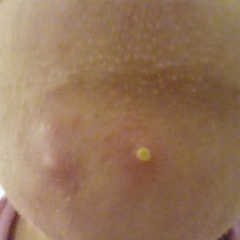 Cilt Bakımı Sonrası Sorunlar Ve İletişim Problemleri