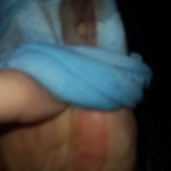 Kusurlu Ayakkabı İadesinde Gecikme Ve Tehlikeli Çivi Sorunu