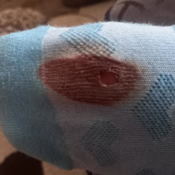 Kusurlu Ayakkabı İadesinde Gecikme Ve Tehlikeli Çivi Sorunu