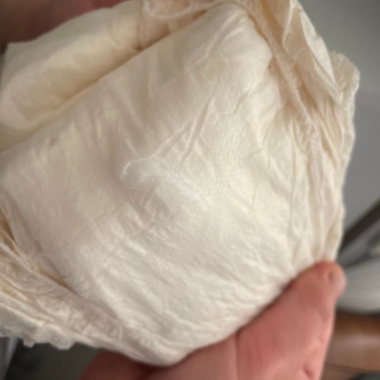 Bebek Bezi Jelleri Ciltte Kızarıklık Ve Kaşıntı Yapıyor