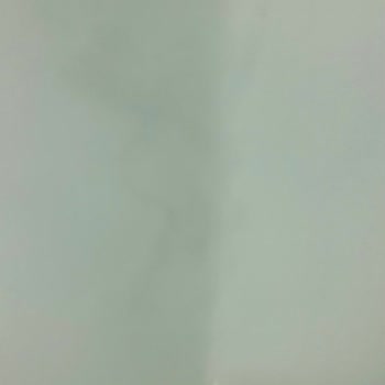 Anadolu Sigorta İle Hasar Tespiti Ve İletişim Sorunları