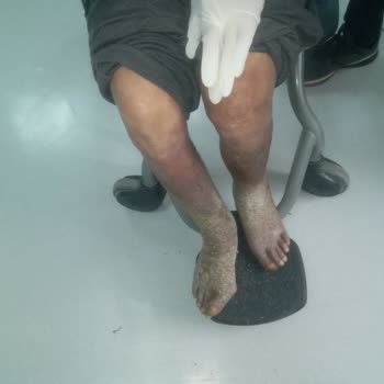 Sağlık Sisteminde Hasta Mağduriyeti