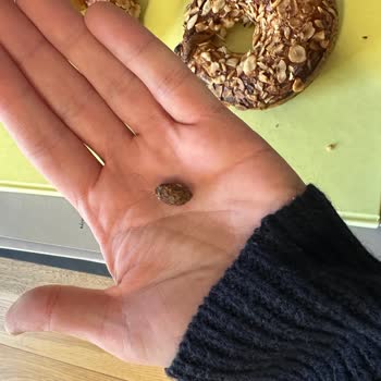 Ekmekteki Zeytin Çekirdeği Dişimi Kırdı