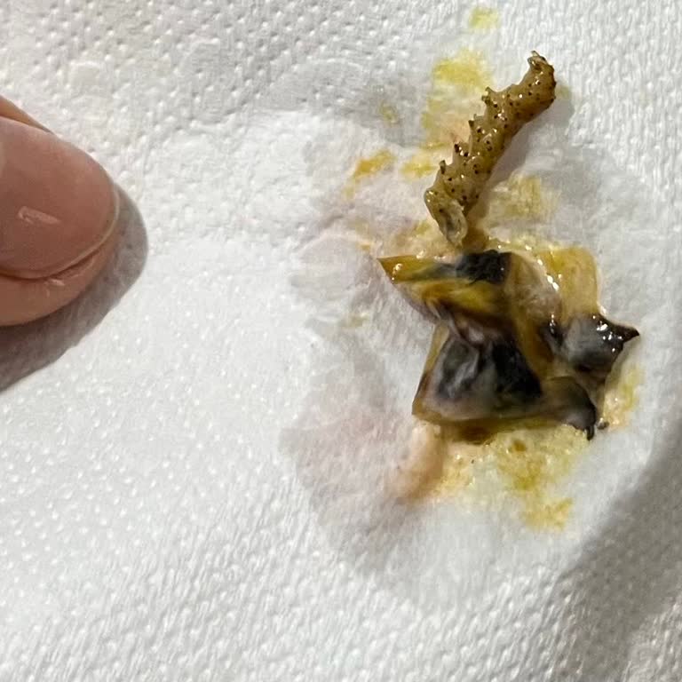 Besaş Turşusundan Çıkan Böcek Şoku