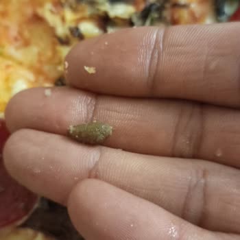 Zeytin Çekirdeği Yüzünden Kırılan Diş Ve Yetersiz Çözüm