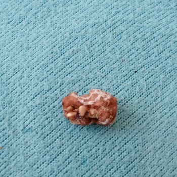 A101'den Aldığım Çerezya Fıstıkların İçinden Böcek Çıkması