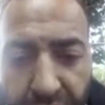 Enpara Gereksiz Yere Bloke Koydu!