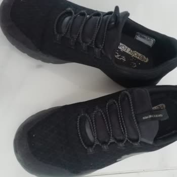 Skechers Ayakkabının Garanti Sorunu Ve Müşteri Mağduriyeti