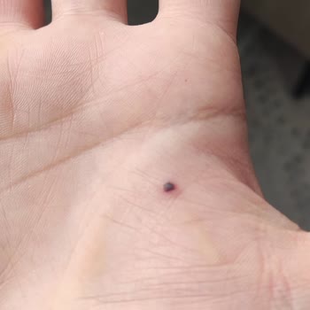 Yanlış Ürün Gönderimi Ve Güvenlik Sorunu