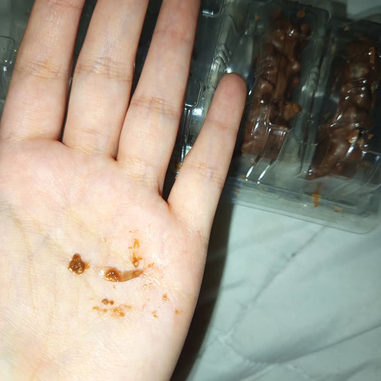 Gofret İçinden Çıkan Yabancı Madde Şoku