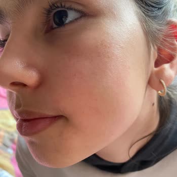 Mustela Yüz Kreminde Beklenmedik İçerik Değişikliği