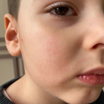 Mustela Yüz Kreminde Beklenmedik İçerik Değişikliği