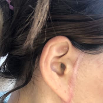 Gözde Herşey - Dr. Semih Doğan Estetik Ameliyat Kabusu: Yanlış İşlemler Ve Belgesiz Hizmet!