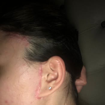 Gözde Herşey - Dr. Semih Doğan Estetik Ameliyat Kabusu: Yanlış İşlemler Ve Belgesiz Hizmet!