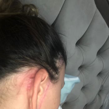 Gözde Herşey - Dr. Semih Doğan Estetik Ameliyat Kabusu: Yanlış İşlemler Ve Belgesiz Hizmet!