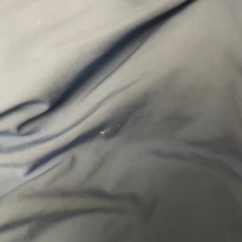 Lacoste Montunda Tüy Sorunu Ve İade Reddedilmesi