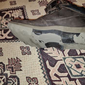 Scooter Ayakkabı Ayak Tabanı Sorunu: Mağduriyetimizin Giderilmesini İstiyoruz