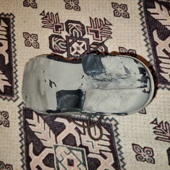 Scooter Ayakkabı Ayak Tabanı Sorunu: Mağduriyetimizin Giderilmesini İstiyoruz