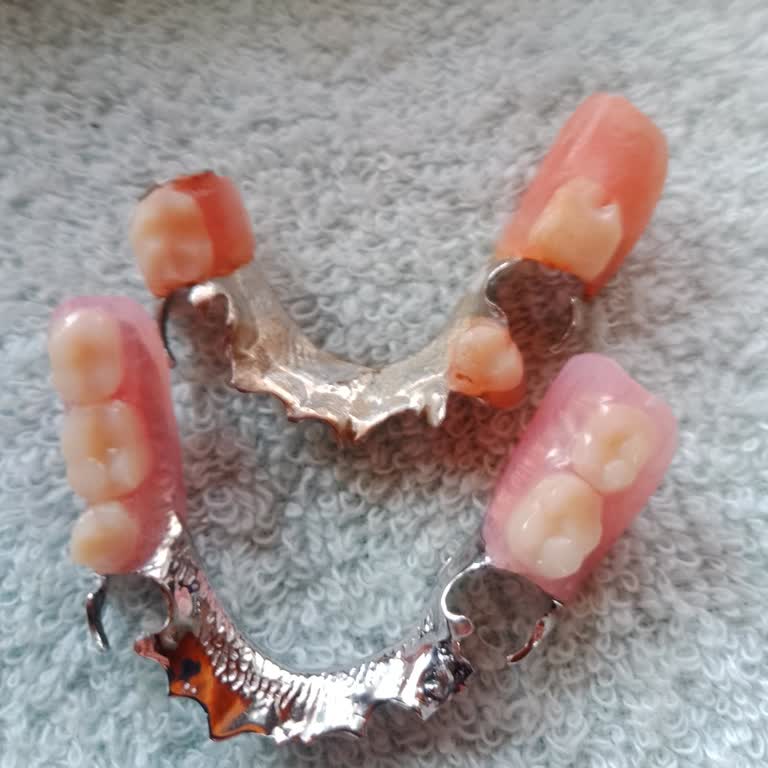 Protez Sorunu Ve İlgisiz Hizmet