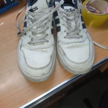 Kısa Sürede Deforme Olan Ayakkabı: Üretim Hatası Mı?