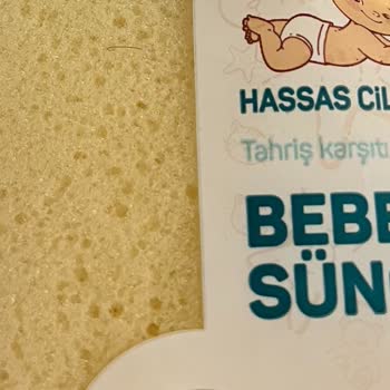 Bebek Ürünlerinde Hijyen Sorunu Ve İlgisiz Müşteri Hizmetleri