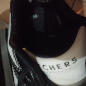 Skechers Ayakkabılarda Yırtılma Ve Koku Sorunu
