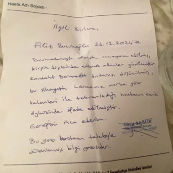 Alerji Yapan Göz Kalemi Ve Mağaza İade Sorunu