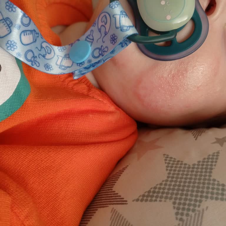 Aptamil Mama Kullanımı Sonrası Cilt Sorunları